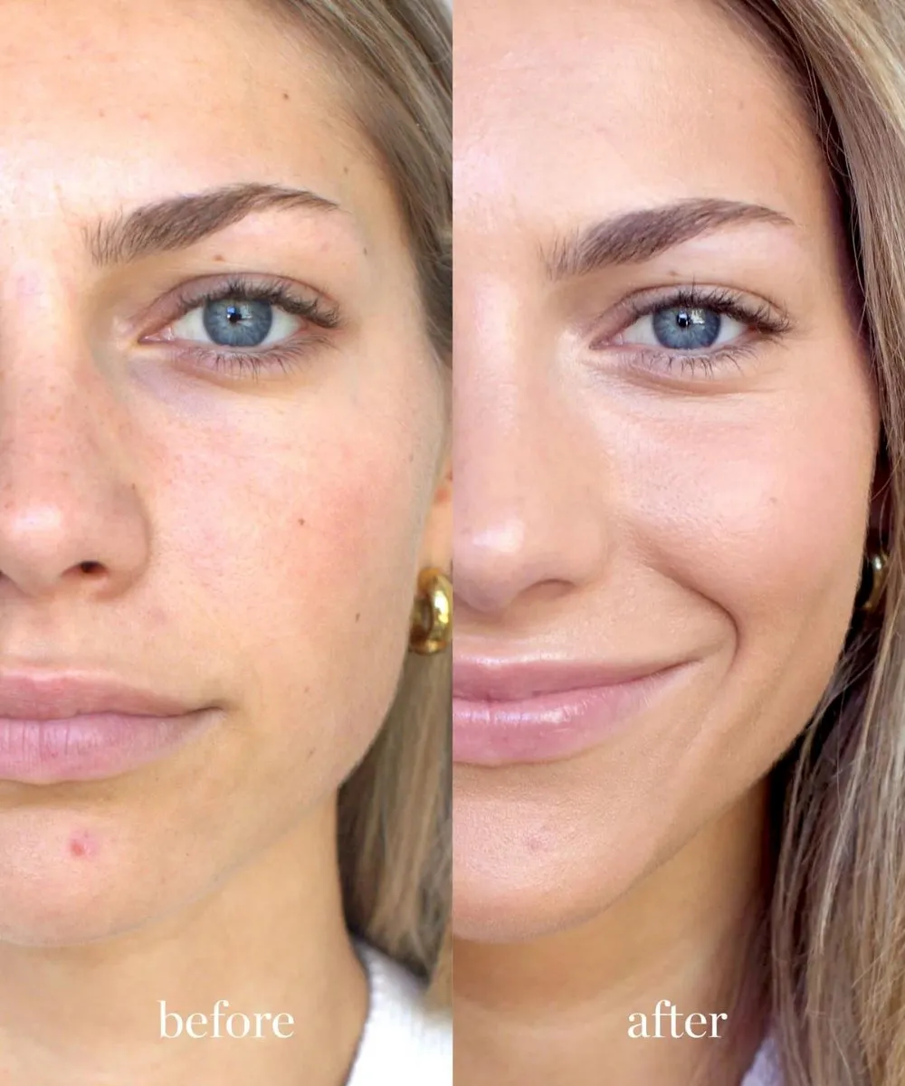 Arnica Concealer