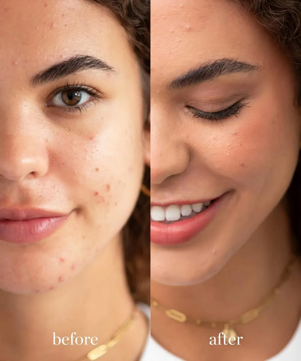 Arnica Concealer