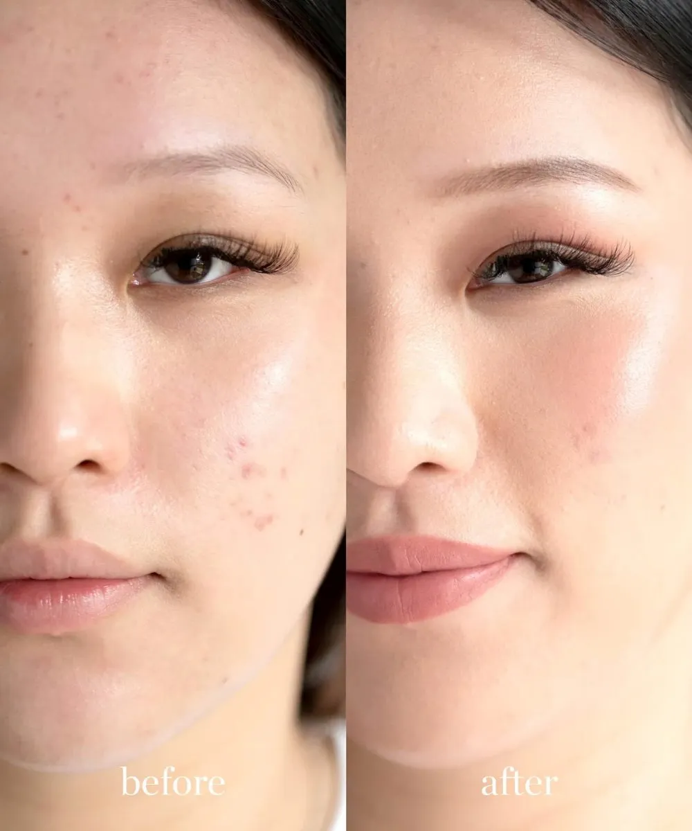 Arnica Concealer